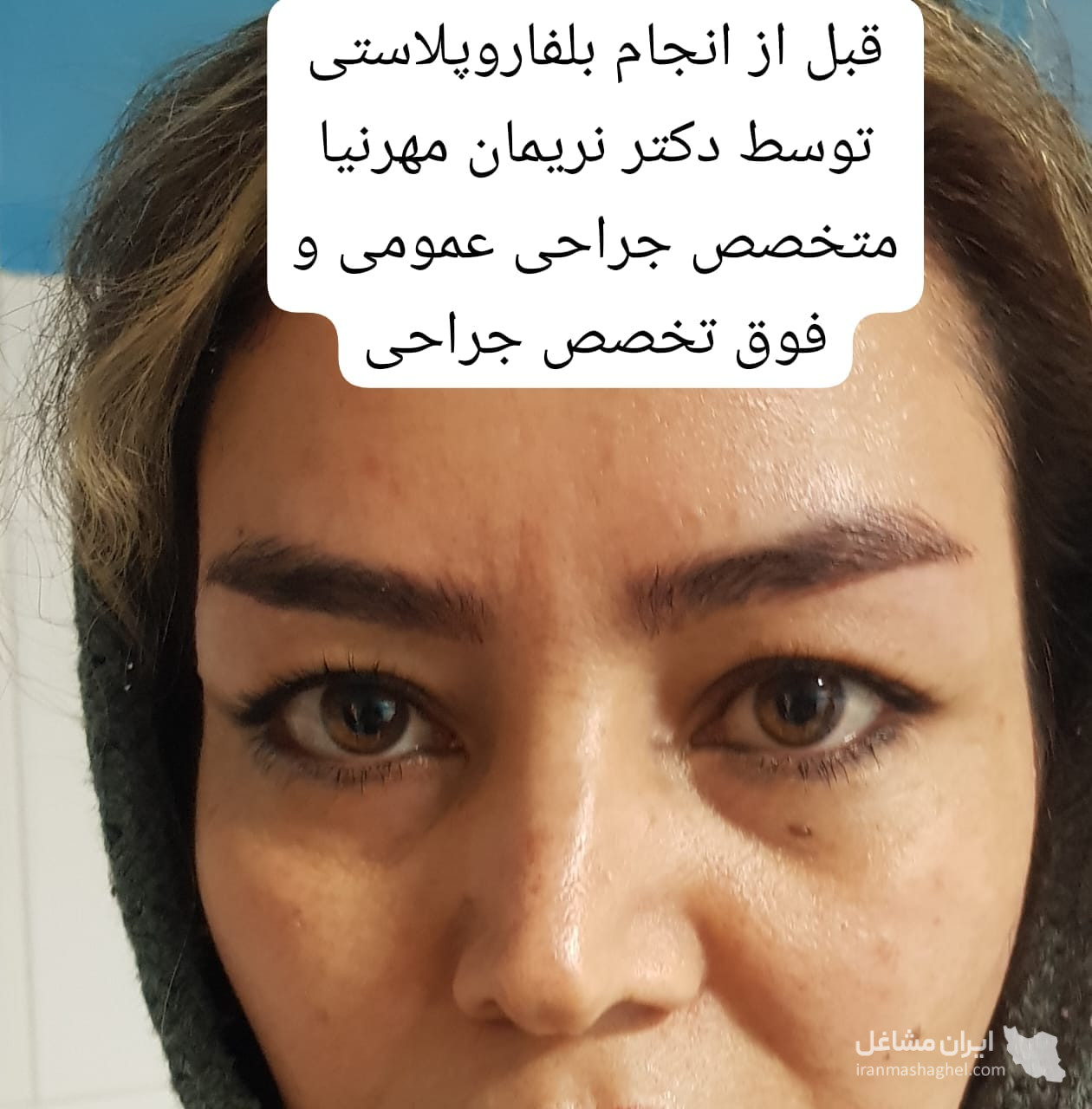 مطب تخصصی پوست و مو دکتر نریمان مهرنیا در تهرانپارس تهران